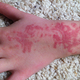 Illustration for article titled Why you should avoid ‘black henna' tattoos
